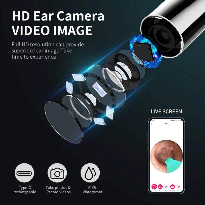 Ear Cleaning Camera with High-Resolution - Edsorts